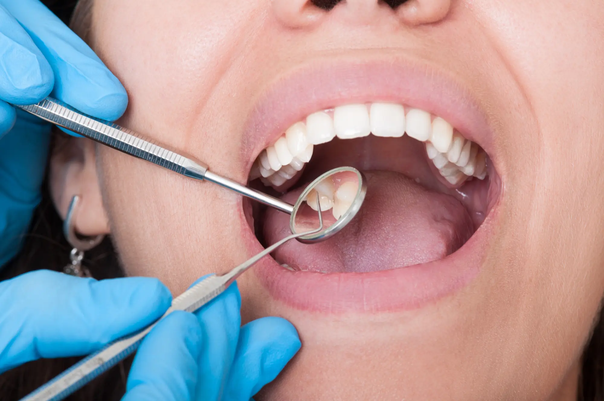 Treatment Image