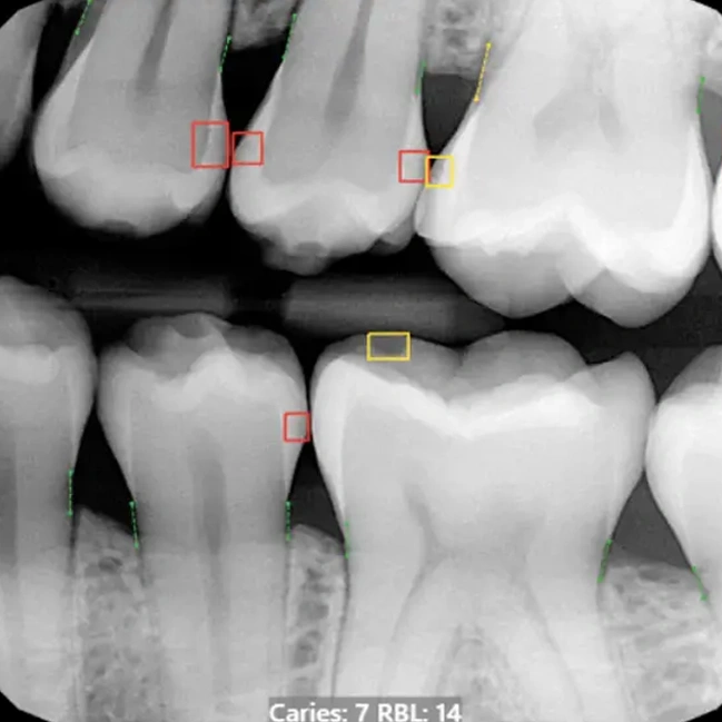 ai-drive-digital-x-rays-image