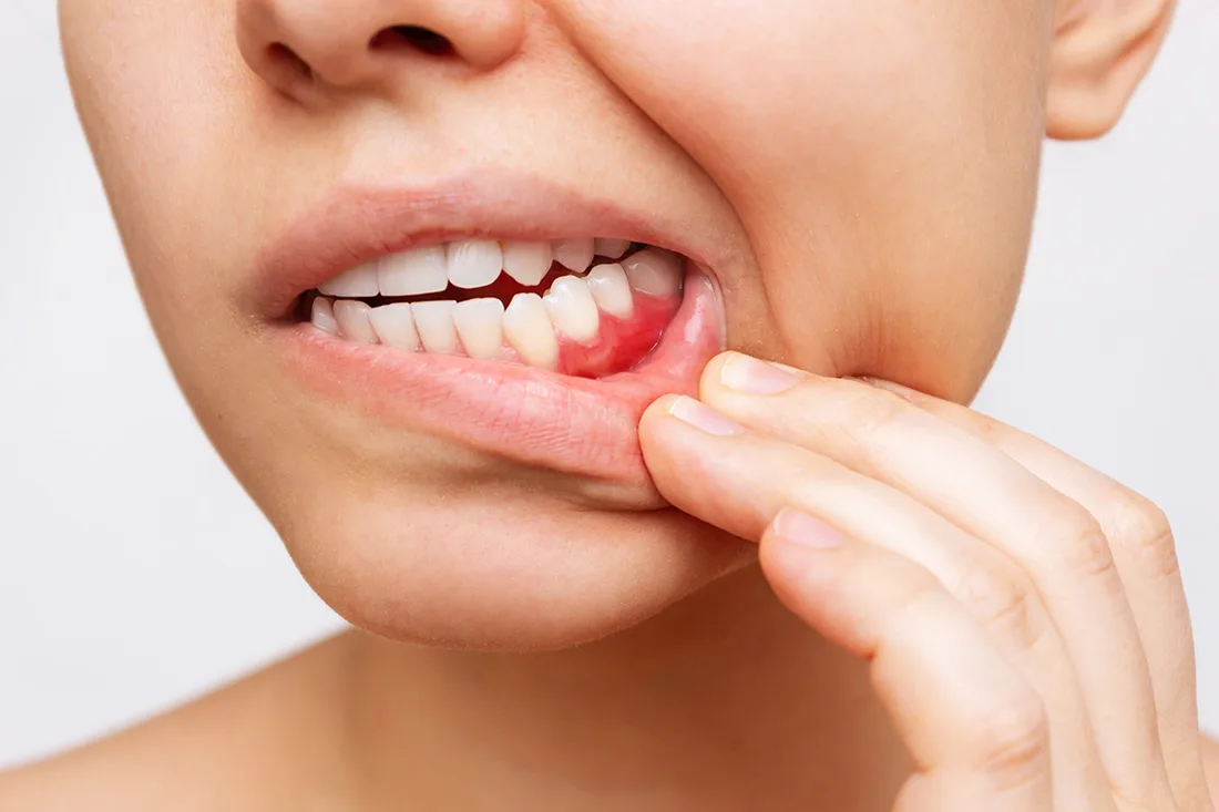 Service Thumbnail Periodontal Care