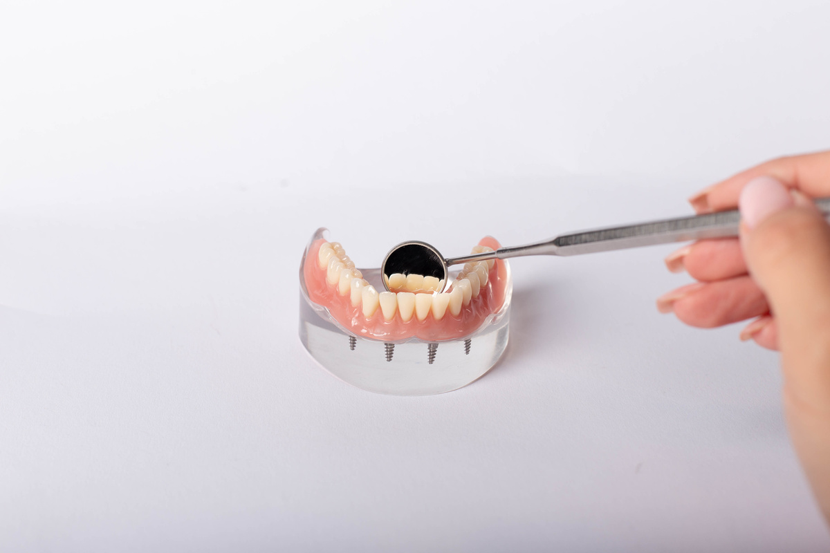 render of mandibular prosthesis all on 4 system supported by implants over white background