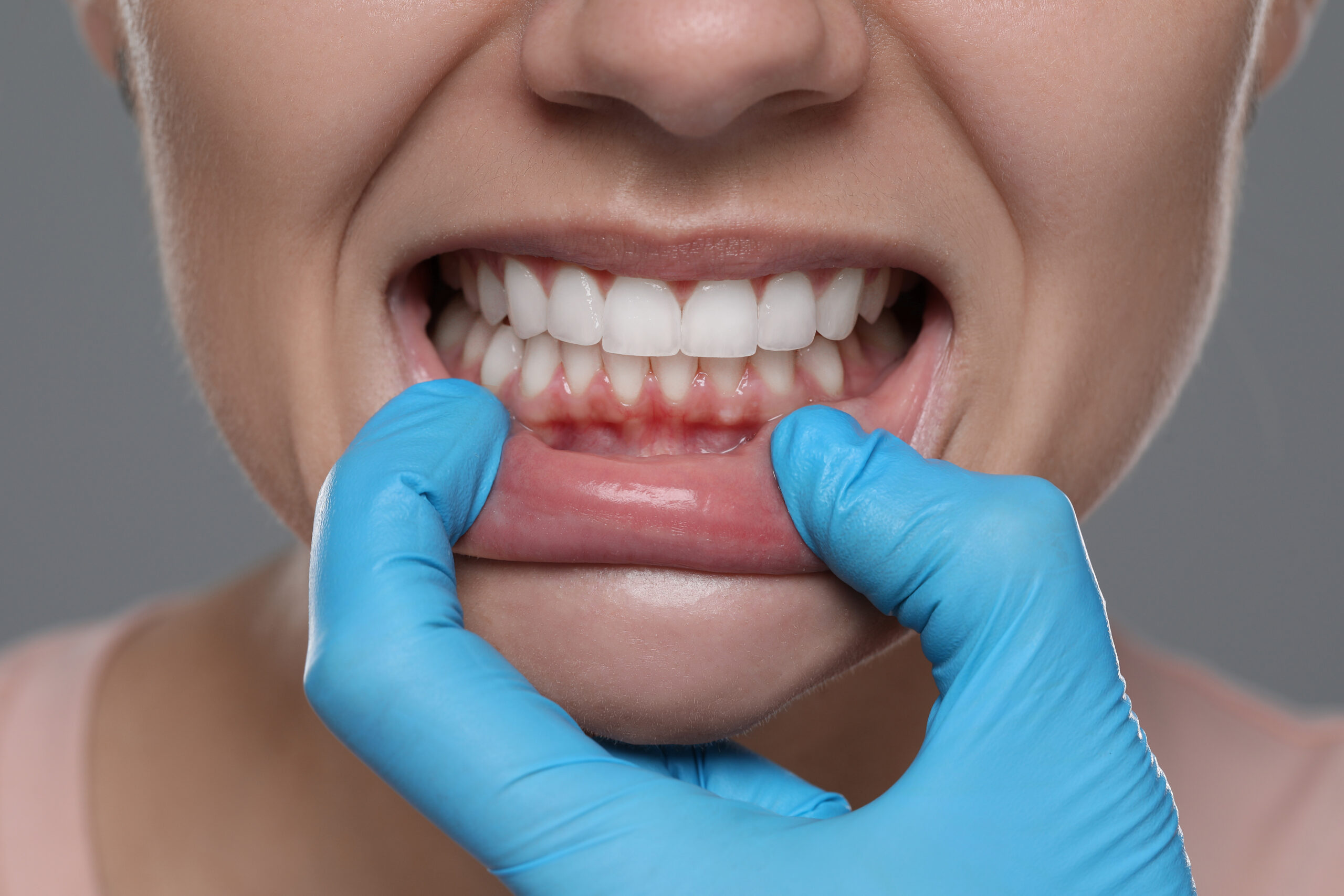 Woman showing healthy gums on gray background, closeup